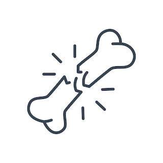 Fracture clipart